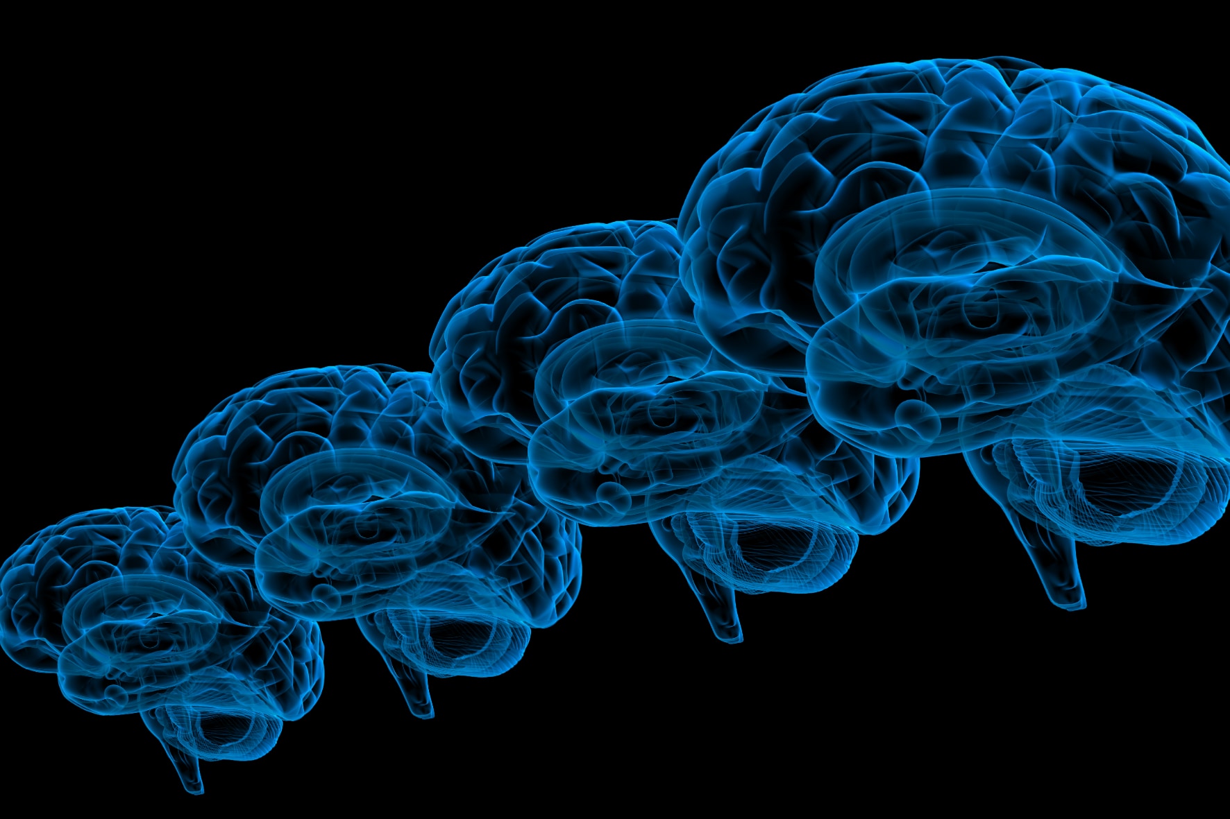 人間の脳は1930年代と比べてかなり大型化して認知症に強くなっていたと判明！